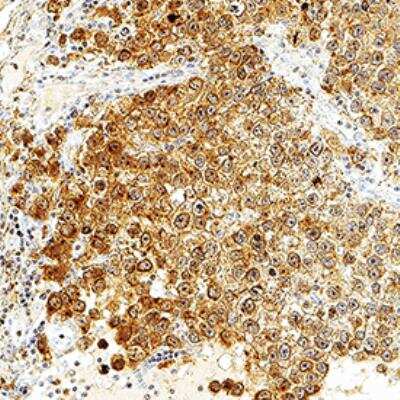 Immunohistochemistry-Paraffin: BAG2 Antibody [NB100-56087]