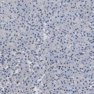 Immunohistochemistry-Paraffin: BAG2 Antibody [NBP2-47544]