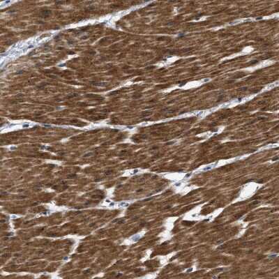 Immunohistochemistry-Paraffin: BAG2 Antibody [NBP2-47544]