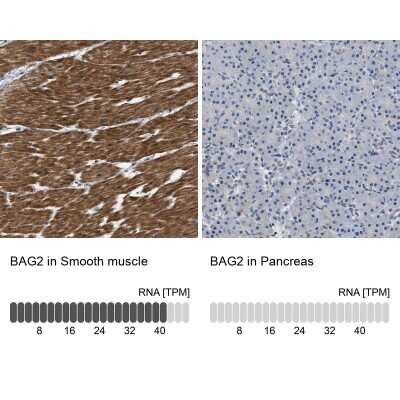 Immunohistochemistry-Paraffin: BAG2 Antibody [NBP2-47544]