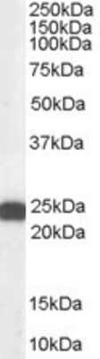 Western Blot: BAG2 Antibody [NB100-1776]