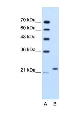 Western Blot: BAG2 Antibody [NBP1-59087]