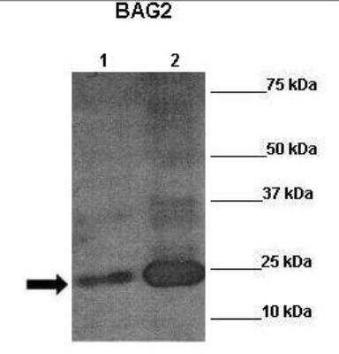 Western Blot: BAG2 Antibody [NBP1-59087]