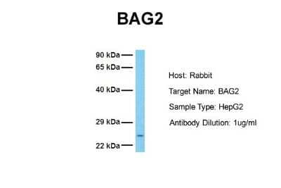 Western Blot: BAG2 Antibody [NBP1-59087]