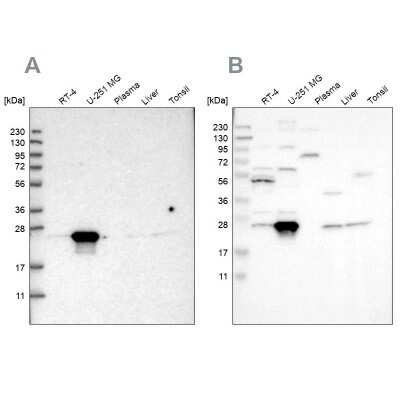 Western Blot: BAG2 Antibody [NBP2-47544]