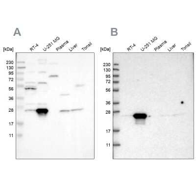 Western Blot: BAG2 Antibody [NBP2-48541]