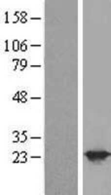 Western Blot: BAG2 Overexpression Lysate [NBP2-07887]