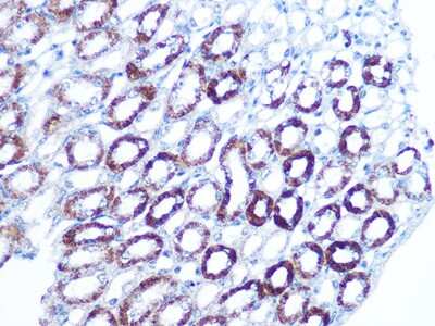 Immunohistochemistry-Paraffin: BAG3 Antibody (8P3W7) [NBP3-16469]