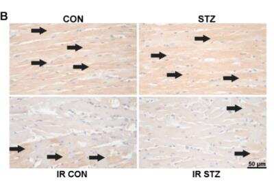 Immunohistochemistry: BAG3 Antibody [NBP2-27398]