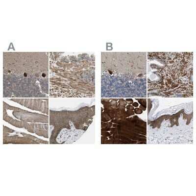 Immunohistochemistry-Paraffin: BAG3 Antibody [NBP1-86429]