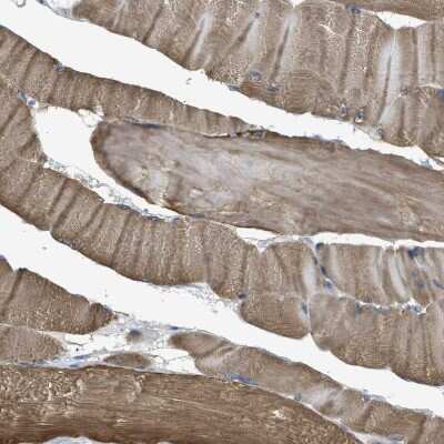 Immunohistochemistry-Paraffin: BAG3 Antibody [NBP1-86429]
