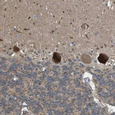 Immunohistochemistry-Paraffin: BAG3 Antibody [NBP1-86429]