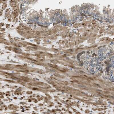 Immunohistochemistry-Paraffin: BAG3 Antibody [NBP1-86429]
