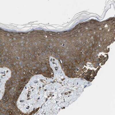 Immunohistochemistry-Paraffin: BAG3 Antibody [NBP1-86429]
