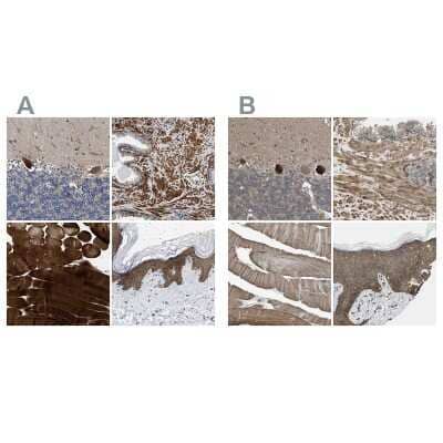 Immunohistochemistry-Paraffin: BAG3 Antibody [NBP1-86442]