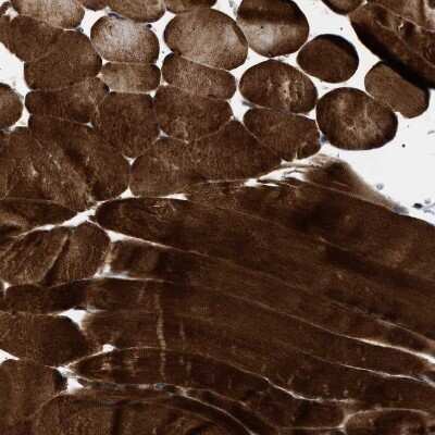 Immunohistochemistry-Paraffin: BAG3 Antibody [NBP1-86442]