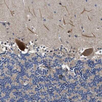 Immunohistochemistry-Paraffin: BAG3 Antibody [NBP1-86442]