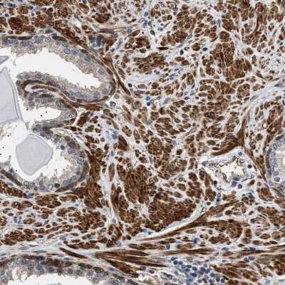 Immunohistochemistry-Paraffin: BAG3 Antibody [NBP1-86442]