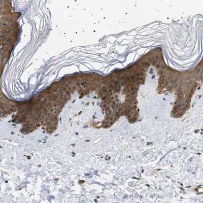 Immunohistochemistry-Paraffin: BAG3 Antibody [NBP1-86442]