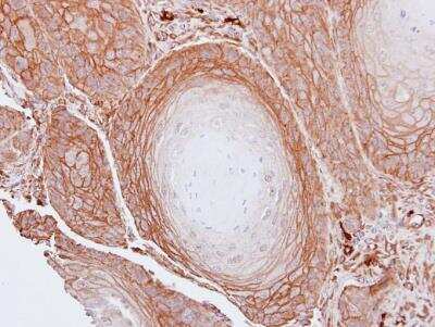 Immunohistochemistry-Paraffin: BAG3 Antibody [NBP2-15543]