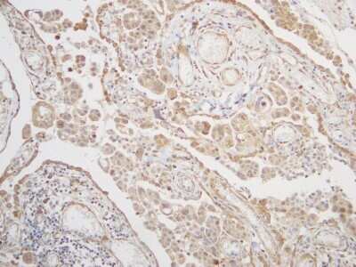 Immunohistochemistry-Paraffin: BAG3 Antibody [NBP2-15543]