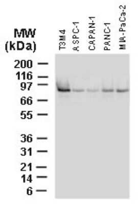 Western Blot: BAG3 Antibody [NBP2-27330]