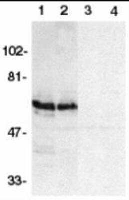 Western Blot: SODD/BAG4 Antibody Blocking Peptide [NBP1-76897PEP]