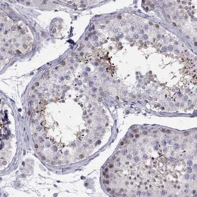Immunohistochemistry-Paraffin: BAG5 Antibody [NBP1-86065]