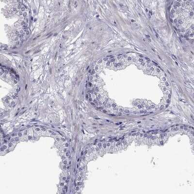 Immunohistochemistry-Paraffin: BAG5 Antibody [NBP1-86065]