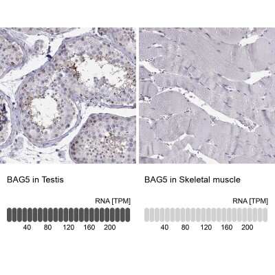 Immunohistochemistry-Paraffin: BAG5 Antibody [NBP1-86065]