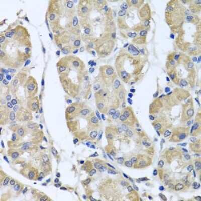 Immunohistochemistry-Paraffin: BAG5 Antibody - BSA Free [NBP2-92791]