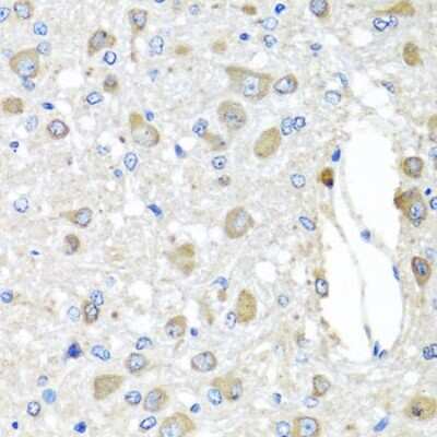 Immunohistochemistry-Paraffin: BAG5 Antibody - BSA Free [NBP2-92791]