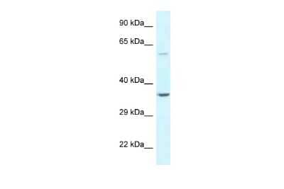 Western Blot: BAG5 Antibody [NBP2-84492]