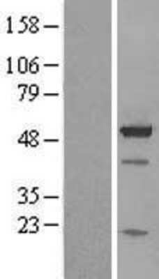 Western Blot: BAG5 Overexpression Lysate [NBL1-07903]