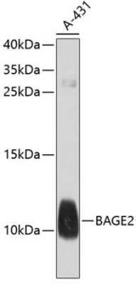 Western Blot: BAGE2 AntibodyBSA Free [NBP3-05566]