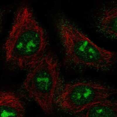 Immunocytochemistry/ Immunofluorescence: BAHCC1 Antibody [NBP2-69028]