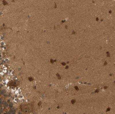 Immunohistochemistry-Paraffin: BAHCC1 Antibody [NBP1-91067]