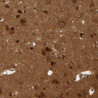 Immunohistochemistry-Paraffin: BAHCC1 Antibody [NBP1-91067]