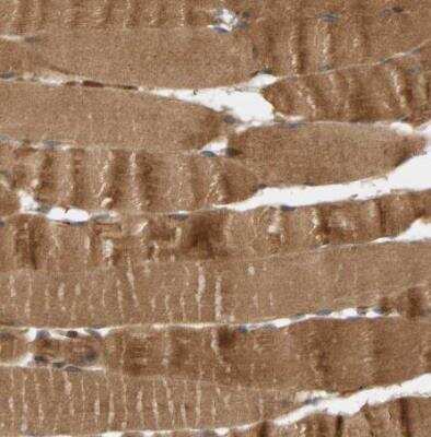 Immunohistochemistry-Paraffin: BAHCC1 Antibody [NBP1-91067]