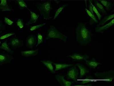 Immunocytochemistry/ Immunofluorescence: BAHD1 Antibody [H00022893-B01P]
