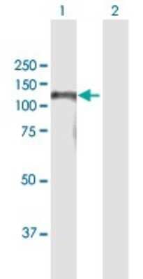 Western Blot: BAHD1 Antibody [H00022893-B01P]