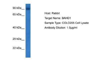 Western Blot: BAHD1 Antibody [NBP2-83945]