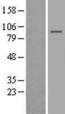 Western Blot: BAHD1 Overexpression Lysate [NBL1-07904]