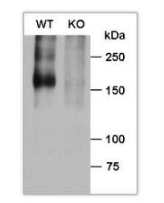 Western Blot: BAI1 Antibody [NB110-81586]