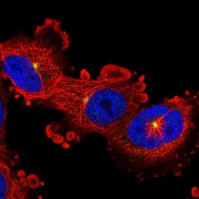 Immunocytochemistry/ Immunofluorescence: BAI2 Antibody [NBP2-56115]