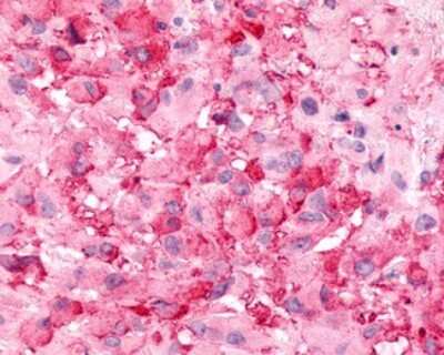 Immunohistochemistry-Paraffin: BAI2 Antibody - BSA Free [NLS981]