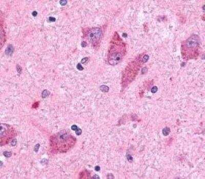 Immunohistochemistry-Paraffin: BAI2 Antibody - BSA Free [NLS981]