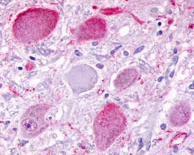 Immunohistochemistry-Paraffin: BAI3 Antibody - BSA Free [NLS979]