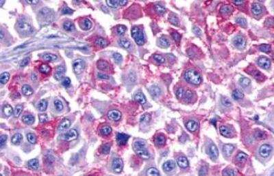 Immunohistochemistry-Paraffin: BAI3 Antibody - BSA Free [NLS979]