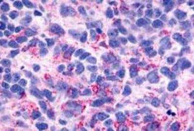 Immunohistochemistry-Paraffin: BAI3 Antibody - BSA Free [NLS979]